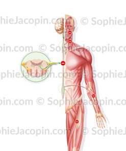 MALADIE DE CHARCOT