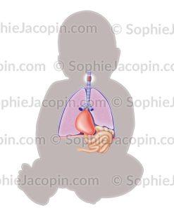 TRAITEMENT HERNIE DIAPHRAGMATIQUE FŒTALE