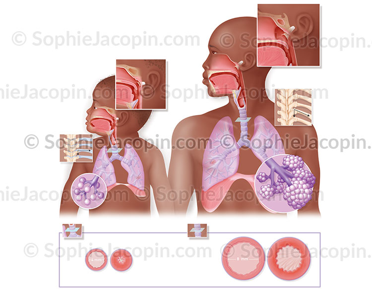 SYSTÈME RESPIRATOIRE ENFANT – Image 5